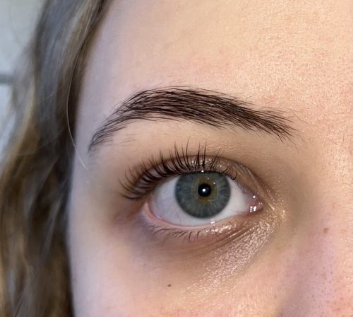 Before and after results