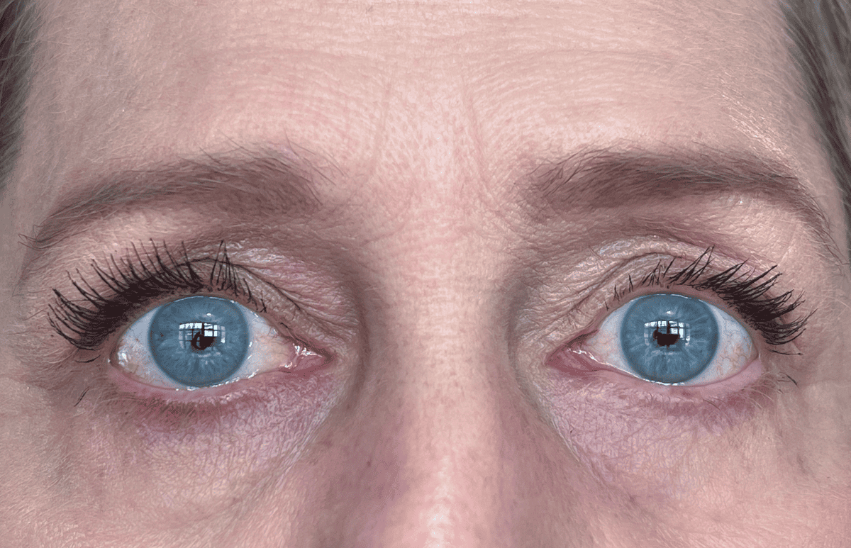 Before and after results